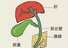 胆囊切除的后遗症有哪些影响大吗