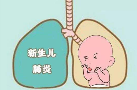 新生儿肺炎护理措施